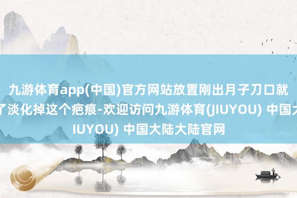 九游体育app(中国)官方网站放置刚出月子刀口就增生了！为了淡化掉这个疤痕-欢迎访问九游体育(JIUYOU) 中国大陆大陆官网